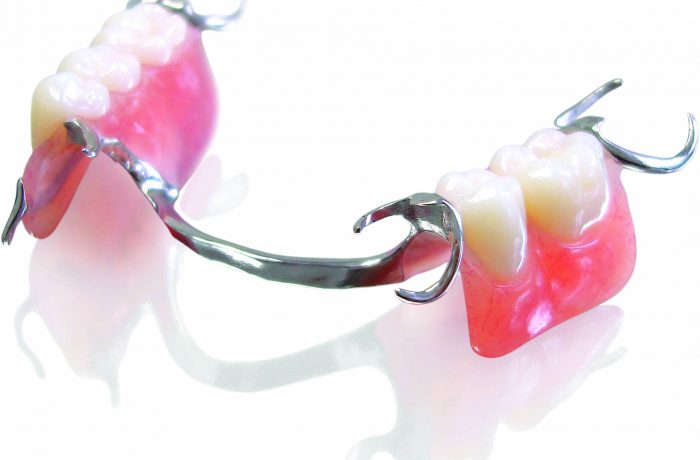 Partial-Dentures_001-700×460