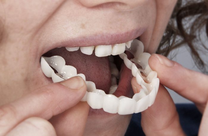 snap-on-smile_001-700×460